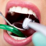 Важность регулярной профилактики и своевременного стоматологического лечения